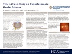 A Case Study on Toxoplasmosis: Ocular Disease by Caleb A. Vass and Elliot Freed