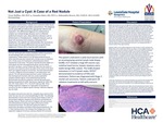 Not Just a Cyst: A Case of a Red Nodule by Tessa B. Mullins, Amanda Johns, and Aleksandra Brown