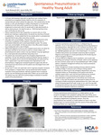 Spontaneous Pneumothorax in Healthy Young Adult by Scott McIntosh and Aaron Keller
