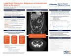 Large Bowel Obstruction: Malignancy vs Endometriosis, Which is the Culprit?