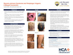 Stevens-Johnson Syndrome and Pemphigus Vulgaris: A Missed Connection