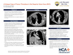 A Unique Case of Tumor Thrombus in the Superior Vena Cava (SVC) by John Leece and Juan Rodriguez