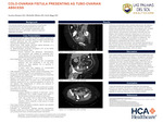 Colo-Ovarian Fistula Presenting as Tubo-Ovarian Abscess by Jessica Harper, Michelle Mieles, and Kyle Biggs