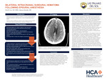 Bilateral Intracranial Subdural Hematoma Following Epidural Anesthesia by Eric B. Cox and Adaeza Onuoha