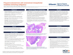 Polypoid Endometriosis with Endometroid Intraepithelial Neoplasia Mimicking Malignancy by Austin T. Jones, Charles M. Quick, and Monique A. Spillman