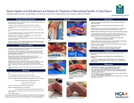 Serial Irrigation and Debridement and Kerecis for Treatment of Necrotizing Fasciitis: A Case Report
