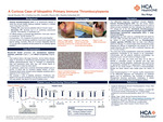 A Curious Case of Idiopathic Primary Immune Thrombocytopenia: A Case Study