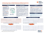 A Shocking Case of Wolf Parkinson White (WPW) Syndrome by Sarah Hendee, Bailey Reale, Tate Higgens, David Taylor, and Dmitriy Scherbak