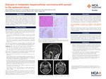 Diplopia in Metastatic Hepatocellular Carcinoma with Spread to the Sphenoid Sinus by Elena Salikhova-Neace, Anna Belits, Petros Keoseyan, Ethan McCarty, Judd Jensen, Katrina Lancaster-Shorts, and Emily Lampe
