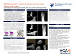 Midfoot Fusion with a Trephine Technique and Novel Dowel Implant: A Case Report by John Savage, Keith Jacobson, Brett Sachs, and Ronnie Pollard