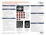 Disseminated Mycobacterium avium Complex (MAC) Infection Presenting with Mycotic Aneurysm and Multisystem Involvement in a Patient with Newly Diagnosed Acquired Immunodeficiency Syndrome (AIDS) by Hannah Rector, Michael Haddad, and Dmitriy Scherbak