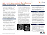 Profound Myxedema Coma without Vital Sign Derangements: A Case Report of Extreme Hypothyroidism and Pituitary Macroadenoma by Christina Mie Minami, Than Sein, Lucas Choy, and Dmitriy Scherbak