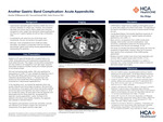 Another Gastric Band Complication: Acute Appendicitis by Dustin Williamson, Naveed Ismail, and John Weaver