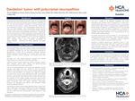 Dandelion Tumor with Polycranial Neuropathies by Elena Salikhova-Neace, Petros Keoseyan, Anna Belits, Ethan McCarty, Judd Jensen, and Emily Lampe