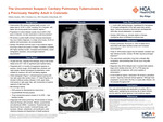 The Uncommon Suspect: Cavitary Pulmonary Tuberculosis in a Previously Healthy Adult in Colorado by Nikita Zanko, Cristina Lee, and Dmitriy Scherbak
