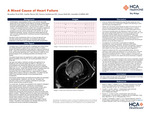 A Mixed Cause of Heart Failure
