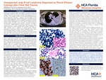 Unsuspected Large B-cell Lymphoma Diagnosed by Pleural Effusion Cytology after Chest Wall Trauma