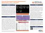 Extra-axial Desmoplastic/Nodular Medulloblastoma, SHH-activated in adult: a case report by Gul Wymer, Fatemeh Mousavi, and Jennifer Barker