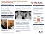 Unusual Case of Repeat Implantable Cardioverter-Defibrillator Migration with Skin Erosion by Brenda Abreu Molnar, Priya Mohan, and Nicolas Hanabergh