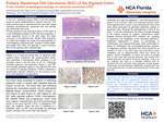 Primary Squamous Cell Carcinoma (SCC) of the Sigmoid Colon: A Rare Location & Histological Subtype of Colorectal Carcinoma (CRC) by Astrid Sacasa, Stachyse Stanis, and Mohtashim Naeem