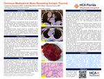 Ominous Mediastinal Mass Revealing Ectopic Thyroid by Cameron Summers, Gabriella Morey, and Susana Ferra