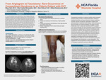 From Angiogram to Fasciotomy: Rare Occurrence of Compartment Syndrome in an Elderly Patient with DVT by Maya Itani, Bita Crystal Behaeddin, Alan Patrus, and Rafael Bustamante