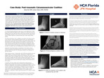 Case Study: Post-traumatic Calcaneonavicular Coalition by JiHae Kim and James Clancy