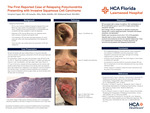 The First Reported Case of Relapsing Polychondritis Presenting with Invasive Squamous Cell Carcinoma by Navpreet Uppal, Lili Janasky, Maha Abdulla, and Mohamad Saad