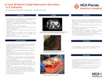 A Case of Gastric Outlet Obstruction Secondary to A Gallstone by Mahesh Tummala, Adam Devine, Akash Tummala, and Livasky Concepcion-Perez