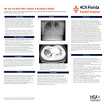 Oil and Air Don’t Mix: Vitamin E Acetate in EVALI by Angelo Lopez-Lacayo, Jordan Taylor-Bentley, Josef Masseli, Michelle Silva, Christy Diaz, and Daniel Zapata