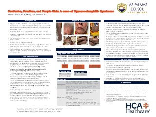 Confusion, Pruritus, and Purple Skin: A case of Hypereosinophilic Syndrome