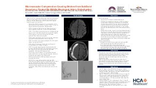 Microvascular Compression Causing Strokes from Subdural Hematoma Treated by Middle Meningeal Artery Embolization