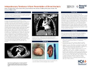 Intrapulmonary Teratoma: A Rare Presentation of Bronchiectasis