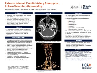 Petrous Internal Carotid Artery Aneurysm: A Rare Vascular Abnormality