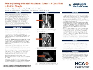 Primary Retroperitoneal Mucinous Tumor – A Cyst That Is Not So Simple