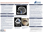 Squamous Cell Carcinoma of the Oral Cavity During Intubation