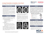 Unique Presentation of Cerebritis: A Case Report