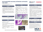 Acute Appendicitis Secondary to Enterobius Vermicularis: Case Report