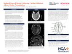 Isolated Case of Alexia following Cardiac Ablation: A Rare Stroke Presentation by Matthew M. Mason, Nantian Harsell, and Bryan Kharbanda
