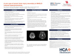 A Rare Case of Anoxic Brain Injury Secondary to MASLD-Induced Hyperammonemia by Renu Thomas, Nhu Chau T. Nguyen, Daniel Bao, Jonathan Tang, Uzma Ali, and Damon Cao