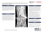 Arteriovenous Fistula Communicating with Venous Stent in Aptient with Arterial Aneurysm by Timot Kellermayer, Renley Summay, and Bryan Kharbanda