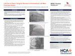 Left Out of Place: Surgical Revision of Anomalous Left Main Coronary Artery