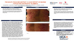 A South Texas Mousetrap: a Case Report of Murine Typhus and Diagnostic Dilemmas