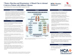 Watery Diarrhea and Hypotension: A Missed Clue to Adrenal Crisis in a Patient with Addison's Disease by Wafa Mehboob, Umema Irfan, and Keyaben Patel