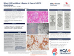 When CKD Isn't What It Seems: A Case of LECT2 Amyloidosis