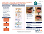 A Rare Case of New Onset Lisinopril-Induced Angioedema Improved with Tranexamic Acid: A Case Report by Hafiz Numan Ijaz, Shahzaib Maqbool, and Yugandhar Kandimalla