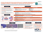 Atypical Del(5q) Mutation in Myelodysplastic Syndrome Presenting with Thrombocytopenia: A Case Report of Tp53-Mutated High-Risk Biology by Shahzaib Maqbool, Munaf Siyamwala, Amelia Goslin, Shivani R. Scharf, and Katsiaryna Laziuk