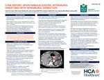 Case Report: Spontaneous Gastric Intramural Hematoma with Intramural Dissection