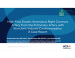 High-Flow Ectatic Anomalous Right Coronary Artery from the Pulmonary Artery with Stimulant-Induced Cardiomyopathy: A Case Report