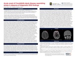 Acute Onset of Creutzfeldt-Jakob Disease Resembling Stroke in Absence of Diagnostic EEG Findings by Erika Juliani and Mathew Calestino